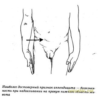 Боль в животе у ребенка при аппендиците